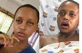 Girl hit by stray bullet during operation against street vendors given job at  KCCA