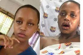 Girl hit by stray bullet during operation against street vendors given job at  KCCA