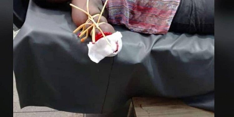 Police launch manhunt for jilted lover who severed wife’s hand in Ibanda