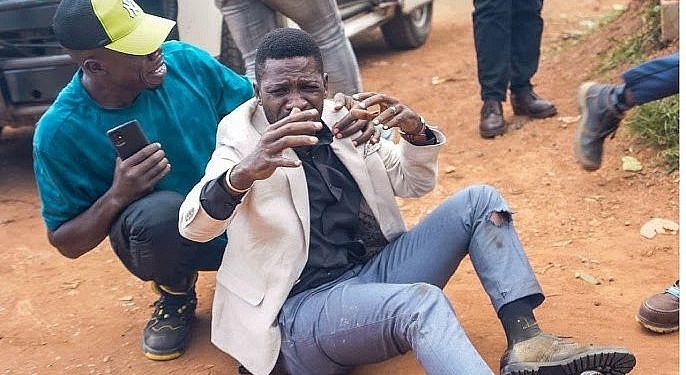 Bobi was not shot- Police insist