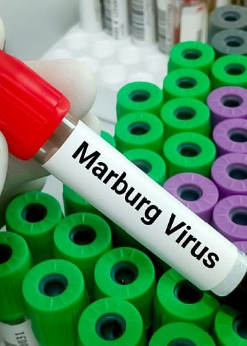 Ethiopia confirms first Marburg outbreak 