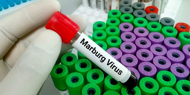 Ethiopia confirms first Marburg outbreak