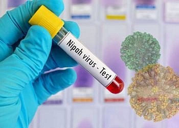 No Nipah virus outbreak in Uganda- Health Ministry