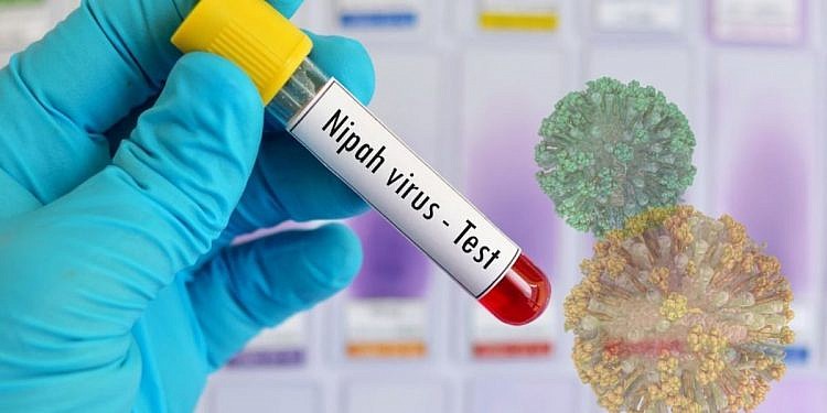 No Nipah virus outbreak in Uganda- Health Ministry
