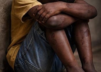 Mityana tops Uganda’s child abuse cases- Police