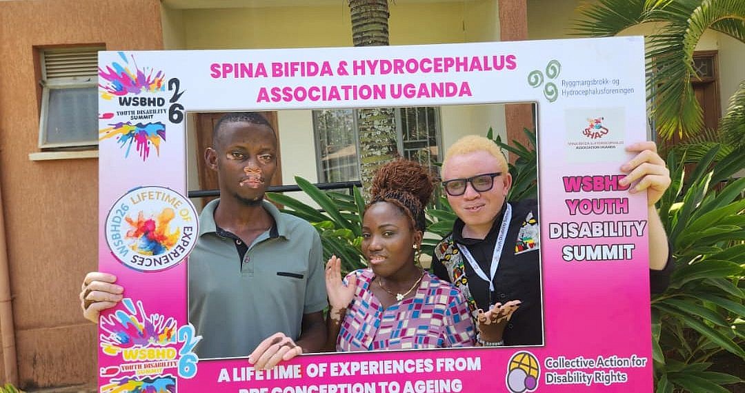 Youths with Albinism, Vitiligo ask gov’t to scrap taxes on sunscreen