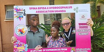 Youths with Albinism, Vitiligo ask gov’t to scrap taxes on sunscreen