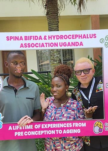 Youths with Albinism, Vitiligo ask gov’t to scrap taxes on sunscreen